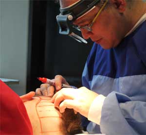 Affordable Hair Transplantation, Hair Restoration, Hair Loss Treatment, Baldness Treatment, Eyebrow Transplant, Eyelash Transplant, Facial Hair, Corrective Procedures in Manila Philippines, Asia and the Pacific